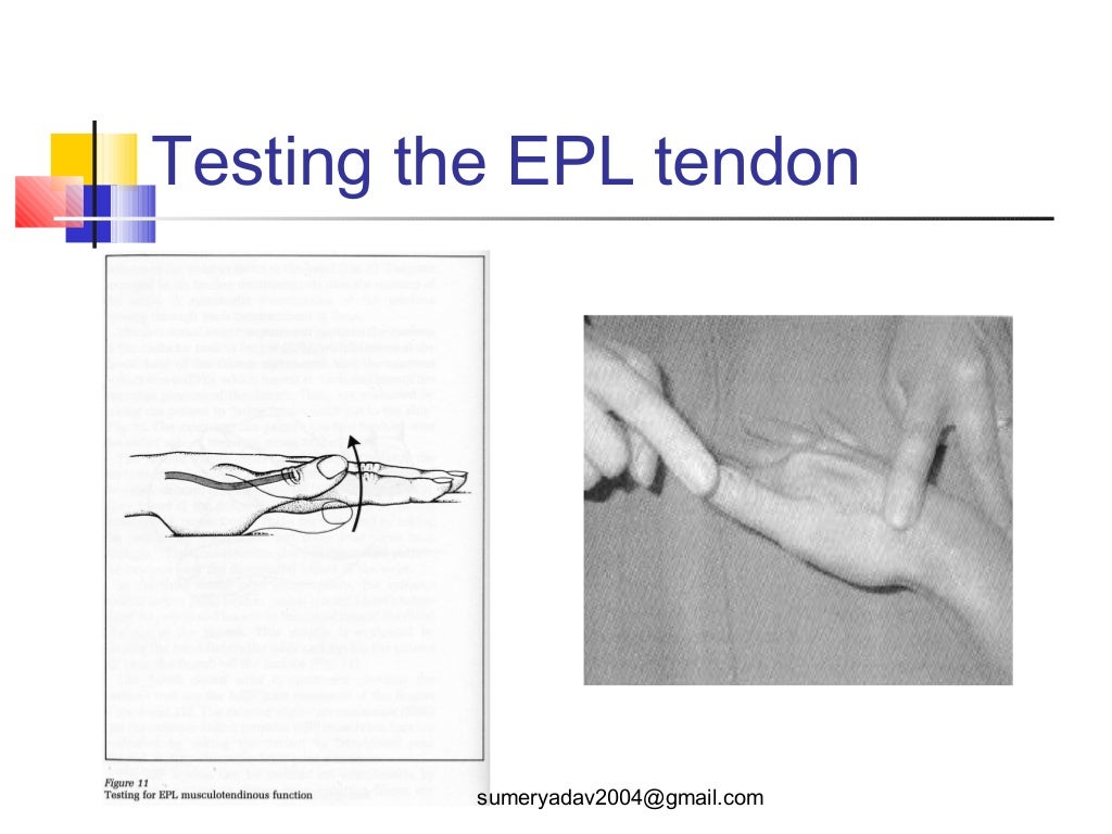 extensor tendons injury and deformity