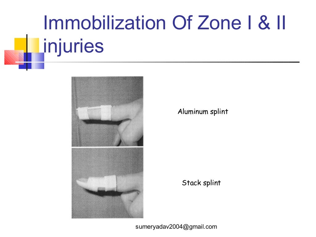 extensor tendons injury and deformity