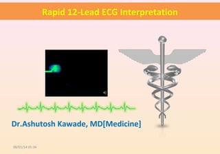 Rapid 12-Lead ECG Interpretation
Dr.Ashutosh Kawade, MD[Medicine]
08/01/14 05:34
 
