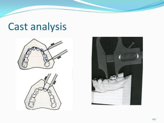Cast analysis




                107
 