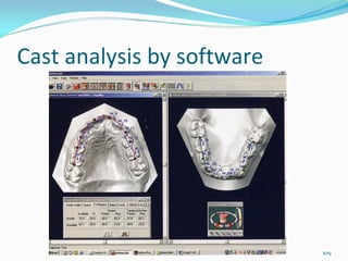 Cast analysis by software




                            109
 