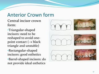 Anterior Crown form
Central incisor crown 
form:
•Triangular‐shaped 
incisors: need to be 
reshaped to avoid one‐
point contact (→ black 
triangle and unstable)
•Rectangular‐shaped 
incisors: good esthetics
•Barrel‐shaped incisors: do 
not provide ideal esthetics 

                               17
 