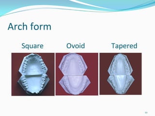 Arch form
  Square             Ovoid               Tapered




                                                   22
 