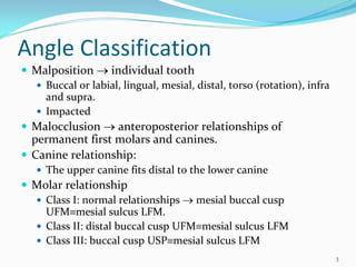 Angle Classification
 Malposition → individual tooth
   Buccal or labial, lingual, mesial, distal, torso (rotation), infra 
   and supra. 
   Impacted 
 Malocclusion → anteroposterior relationships of  
 permanent first molars and canines. 
 Canine relationship: 
   The upper canine fits distal to the lower canine
 Molar relationship 
   Class I: normal relationships → mesial buccal cusp 
   UFM≡mesial sulcus LFM.
   Class II: distal buccal cusp UFM≡mesial sulcus LFM
   Class III: buccal cusp USP≡mesial sulcus LFM
                                                                         3
 