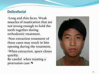 Dolicofacial
•Long and thin faces. Weak 
muscles of mastication that are 
not strong enough to hold the 
teeth together during 
orthodontic treatment. 
•Non extraction treatment of 
these cases may result in bite 
opening during the treatment. 
•When extraction, space closes 
quickly.
Be careful  when treating a 
protrusion case  

                                   49
 