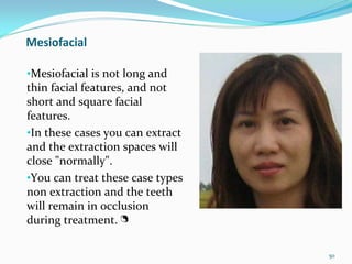 Mesiofacial

•Mesiofacial is not long and 
thin facial features, and not 
short and square facial 
features. 
•In these cases you can extract 
and the extraction spaces will 
close "normally". 
•You can treat these case types 
non extraction and the teeth 
will remain in occlusion 
during treatment.

                                   50
 