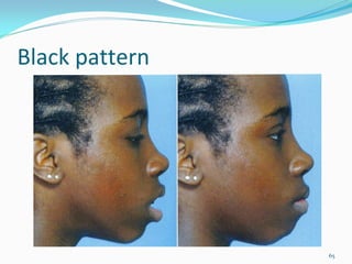 Black pattern




                65
 