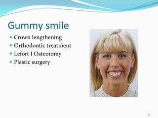 Gummy smile
 Crown lengthening
 Orthodontic treatment
 Lefort I Osteotomy
 Plastic surgery




                         73
 