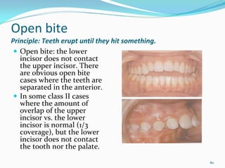Open bite 
Principle: Teeth erupt until they hit something. 
   Open bite: the lower 
   incisor does not contact 
   the upper incisor. There 
   are obvious open bite 
   cases where the teeth are 
   separated in the anterior. 
   In some class II cases 
   where the amount of 
   overlap of the upper 
   incisor vs. the lower 
   incisor is normal (1/3 
   coverage), but the lower 
   incisor does not contact 
   the tooth nor the palate. 

                                                    80
 