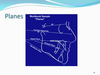 Planes




         88
 