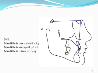 SNB
Mandible is protrusive if > 83
Mandible is average if  76 – 82 
Mandible is retrusive if <75




                                   95
 