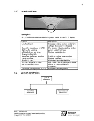 Rev 1 January 2009
Welding Imperfections and Materials Inspection
Copyright © TWI Ltd 2009
5.1.3 Lack of root fusion
Description
Lack of fusion between the weld and parent metal at the root of a weld.
Causes Prevention
Low heat input Increase welding current and/or arc
voltage; decrease travel speed
Excessive inductance in MAG
dip transfer welding,
Use correct induction setting for the
parent metal thickness
MMA electrode too large
(low current density)
Reduce electrode size
Use of vertical down welding Switch to vertical up procedure
Large root face Reduce root face
Small root gap Ensure correct root opening
Incorrect angle or incorrect
electrode manipulation
Use correct electrode angle. Ensure
welder is fully qualified and
competent
Excessive misalignment at root Ensure correct alignment
5.2 Lack of penetration
Lack of
penetration
Incomplete
penetration
Incomplete root
penetration
45
 