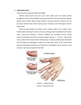 5. TANDA DAN GEJALA
Tanda klinisklienhipoksia(Arif Muttaqin,2008 )
Hipoksia dapat terjadi secara akut atau kronik. Gejala awal dari hipoksia adalah
peningkatan denyut nadi, peningkatan jumlah dan kedalaman nafas, dan diikuti peningkatan
tekanan darah sistolik. Gejala lanjutan hipoksia mencakup penurunan denyut nadi dan
penurunan tekanan darah sistolik, dispnea, batuk, hemoptisis, serta kemungkinan sianosis
dapat timbul.
Gejala lain pada hipoksia akut adalah nause, vomiting, oliguria, dan mungkin anuria.
Hipoksia dapat memengaruhi sistem saraf pusat, sehingga dapat menyebabkan sakit kepala,
apatis ( penurunan kesadaran ), dizzines, iritabilitas, dan kehilangan memori. Korteks
serebral hanya dapat menoleransi terjadinya hipoksia selama 3 – 5 menit. Pada kondisi
lanjut, pada jari klien biasanya timbul clubbing finger. Terjadinya clubbing finger disebabkan
oleh terhambatnya pengangkutan oksigen dan suplai darah arteri ke jari yang ditandai
dengan pembengkakan pada dasar jari menjadi dan meningkatnya ukuran ujung jari, sudut
antara jari,dan dasar jari yang lebihdari 160°.
Gambar 1 : Clubbing Finger
Sumber : healthcentral.com
 
