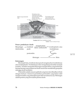78 Panduan Pembelajaran BIOLOGI XI SMA/MA
Proses pembekuan darah:
Bilajaringan trombosit
mengeluarkan
faktor antihemofili
tromboplastin atau
tubuhterluka pecah trombokinase
protrombin ⎯⎯⎯⎯+
ion Ca
trombin
fibrinogen fibrin
Keterangan:
Bila terjadi luka, trombosit akan pecah mengeluarkan trombokinase
atau tromboplastin. Trombokinase akan mengubah protrombin menjadi
trombin. Trombin mengubah fibrinogen menjadi fibrin yang berbentuk
benang-benangyangmenjeratseldarahmerahdanmembentukgumpalan
sehingga darah membeku.
Protrombinadalahsenyawaglobulinyanglarutdandihasilkandihati
dengan bantuan vitamin K (perubahan protrombin yang belum aktif
menjadi trombin yang aktif dipercepat oleh ion kalsium (Ca)). Fibrinogen
adalah protein yang larut dalam plasma darah.
Gambar 5.8 Proses pembekuan darah
Sumber: Oxford Ensiklopedi Pelajar
Bakteri yang memasuki
luka
Keropeng yang
terbentuk di atas luka
menutupi luka tersebut
dengan benang-
benang halus dan sel
darah merah
Zat pembeku darah
yang membentuk
benang-benang halus
Kulit
Pembuluh
darah
Sel darah putih yang
meninggalkan darah untuk
membunuh Kuman-kuman
yang masuk ke dalam luka
Sel darah putih yang
membunuh bakteri
 
