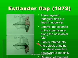lip reconstruction