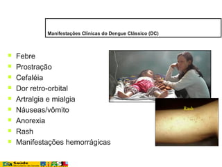  Febre
 Prostração
 Cefaléia
 Dor retro-orbital
 Artralgia e mialgia
 Náuseas/vômito
 Anorexia
 Rash
 Manifestações hemorrágicas
Rash
Manifestações Clínicas do Dengue Clássico (DC)
 