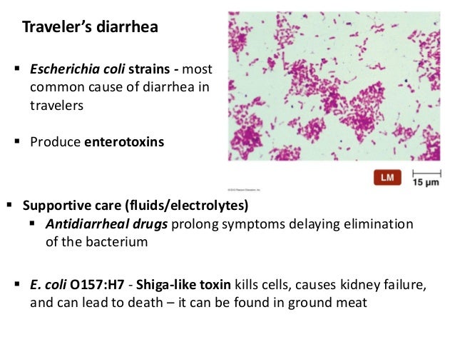 Most Common Cause Of Traveler S Diarrhea Most Common Cause Of Traveler S Diarrhea