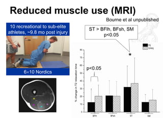 p<0.05 
* 
ST > BFlh, BFsh, SM 
p<0.05 
10 recreational to sub-elite 
athletes, ~9.8 mo post injury 
Reduced muscle use (MRI) 
610 Nordics 
Bourne et al unpublished 
 