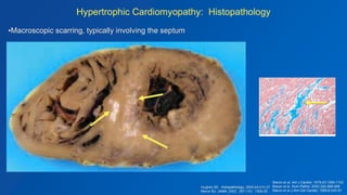 Role of MRI Tissue Characterization in the Evaluation of Heart Disease ...