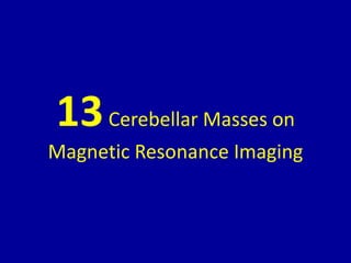 13Cerebellar Masses on
Magnetic Resonance Imaging
 