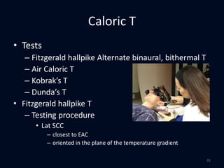 Caloric T
• Tests
– Fitzgerald hallpike Alternate binaural, bithermal T
– Air Caloric T
– Kobrak’s T
– Dunda’s T
• Fitzgerald hallpike T
– Testing procedure
• Lat SCC
– closest to EAC
– oriented in the plane of the temperature gradient
31
 