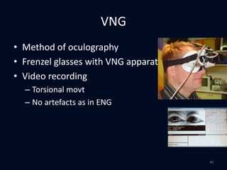 VNG
• Method of oculography
• Frenzel glasses with VNG apparatus
• Video recording
– Torsional movt
– No artefacts as in ENG
40
 