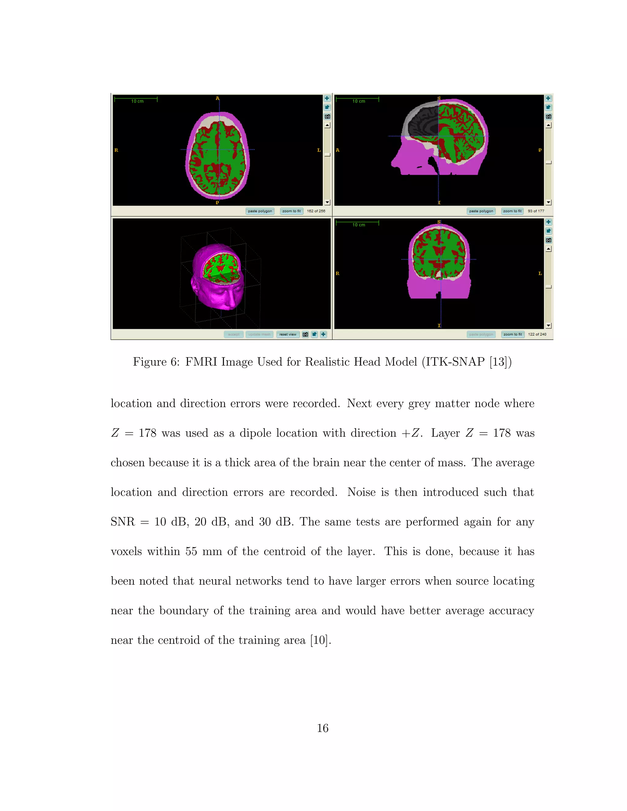 Figure 6: FMRI Image Used for Realistic Head Model (ITK-SNAP [13])
location and direction errors were recorded. Next every grey matter node where
Z = 178 was used as a dipole location with direction +Z. Layer Z = 178 was
chosen because it is a thick area of the brain near the center of mass. The average
location and direction errors are recorded. Noise is then introduced such that
SNR = 10 dB, 20 dB, and 30 dB. The same tests are performed again for any
voxels within 55 mm of the centroid of the layer. This is done, because it has
been noted that neural networks tend to have larger errors when source locating
near the boundary of the training area and would have better average accuracy
near the centroid of the training area [10].
16
 