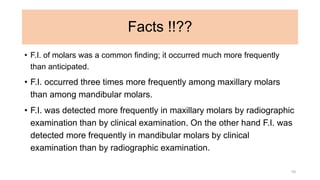 Facts !!??
• F.I. of molars was a common finding; it occurred much more frequently
than anticipated.
• F.I. occurred three times more frequently among maxillary molars
than among mandibular molars.
• F.I. was detected more frequently in maxillary molars by radiographic
examination than by clinical examination. On the other hand F.I. was
detected more frequently in mandibular molars by clinical
examination than by radiographic examination.
10
 