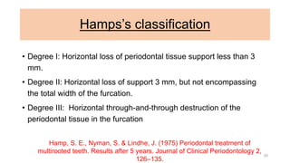 Hamps’s classification
• Degree I: Horizontal loss of periodontal tissue support less than 3
mm.
• Degree II: Horizontal loss of support 3 mm, but not encompassing
the total width of the furcation.
• Degree III: Horizontal through-and-through destruction of the
periodontal tissue in the furcation
Hamp, S. E., Nyman, S. & Lindhe, J. (1975) Periodontal treatment of
multirooted teeth. Results after 5 years. Journal of Clinical Periodontology 2,
126–135.
20
 