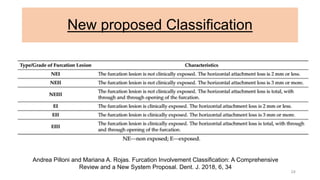 New proposed Classification
24
Andrea Pilloni and Mariana A. Rojas. Furcation Involvement Classiﬁcation: A Comprehensive
Review and a New System Proposal. Dent. J. 2018, 6, 34
 