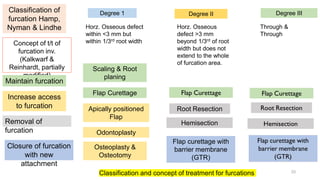 Classification of
furcation Hamp,
Nyman & Lindhe
Degree 1 Degree II Degree III
Concept of t/t of
furcation inv.
(Kalkwarf &
Reinhardt, partially
modified)
Maintain furcation
Increase access
to furcation
Removal of
furcation
Closure of furcation
with new
attachment
Scaling & Root
planing
Flap Curettage
Apically positioned
Flap
Odontoplasty
Osteoplasty &
Osteotomy
Root Resection
Hemisection
Flap curettage with
barrier membrane
(GTR)
Classification and concept of treatment for furcations
Horz. Osseous defect
within <3 mm but
within 1/3rd root width
Through &
Through
Horz. Osseous
defect >3 mm
beyond 1/3rd of root
width but does not
extend to the whole
of furcation area.
33
 