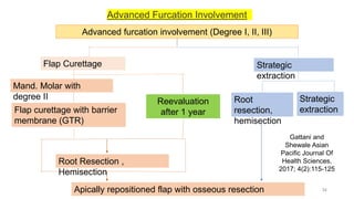Advanced Furcation Involvement
Advanced furcation involvement (Degree I, II, III)
Flap Curettage Strategic
extraction
Root
resection,
hemisection
Strategic
extraction
Mand. Molar with
degree II
Flap curettage with barrier
membrane (GTR)
Root Resection ,
Hemisection
Apically repositioned flap with osseous resection
Reevaluation
after 1 year
Gattani and
Shewale Asian
Pacific Journal Of
Health Sciences,
2017; 4(2):115-125
34
 