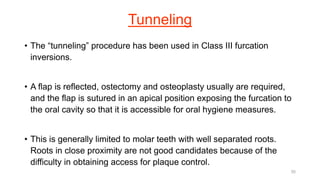 Tunneling
• The “tunneling” procedure has been used in Class III furcation
inversions.
• A flap is reflected, ostectomy and osteoplasty usually are required,
and the flap is sutured in an apical position exposing the furcation to
the oral cavity so that it is accessible for oral hygiene measures.
• This is generally limited to molar teeth with well separated roots.
Roots in close proximity are not good candidates because of the
difficulty in obtaining access for plaque control.
55
 