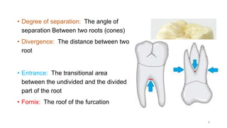 • Degree of separation: The angle of
separation Between two roots (cones)
• Divergence: The distance between two
root
• Entrance: The transitional area
between the undivided and the divided
part of the root
• Fornix: The roof of the furcation
9
 