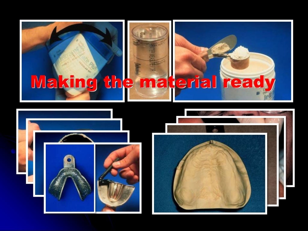 hydrocolloids impression dental material