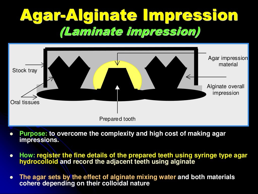hydrocolloids impression dental material