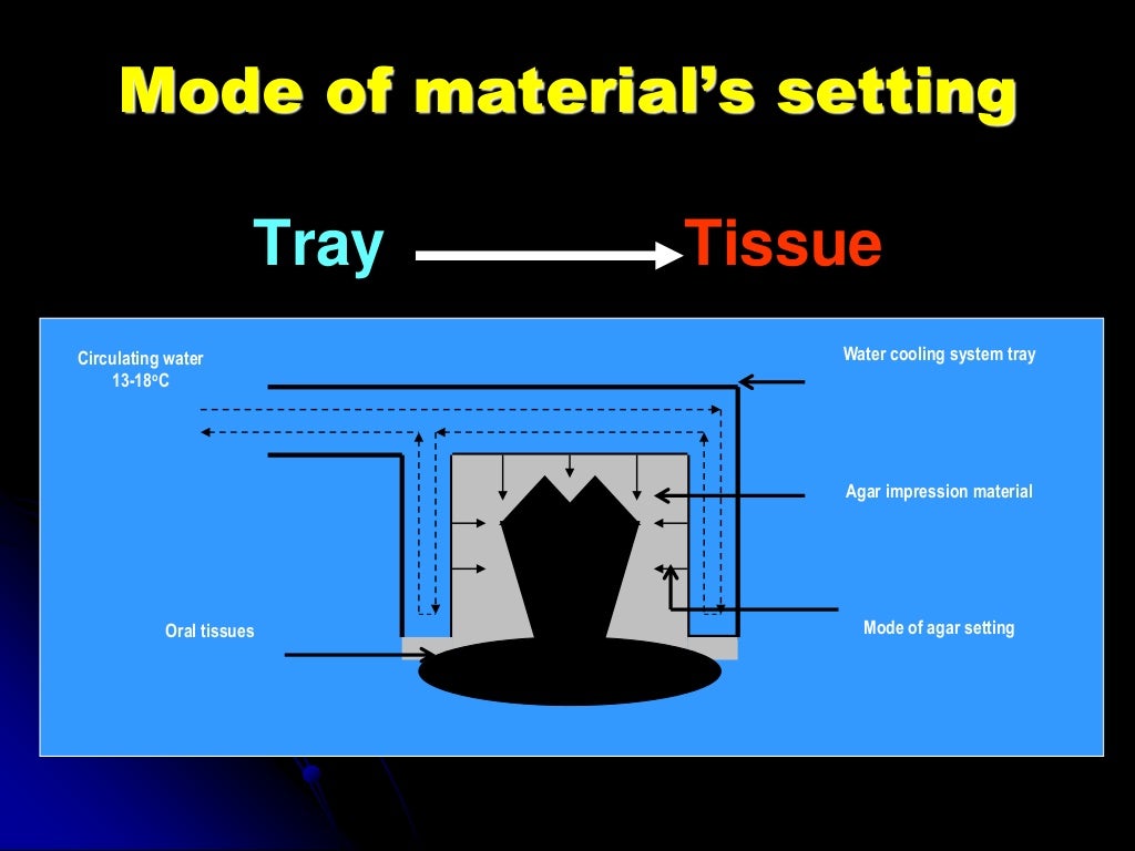 hydrocolloids impression dental material