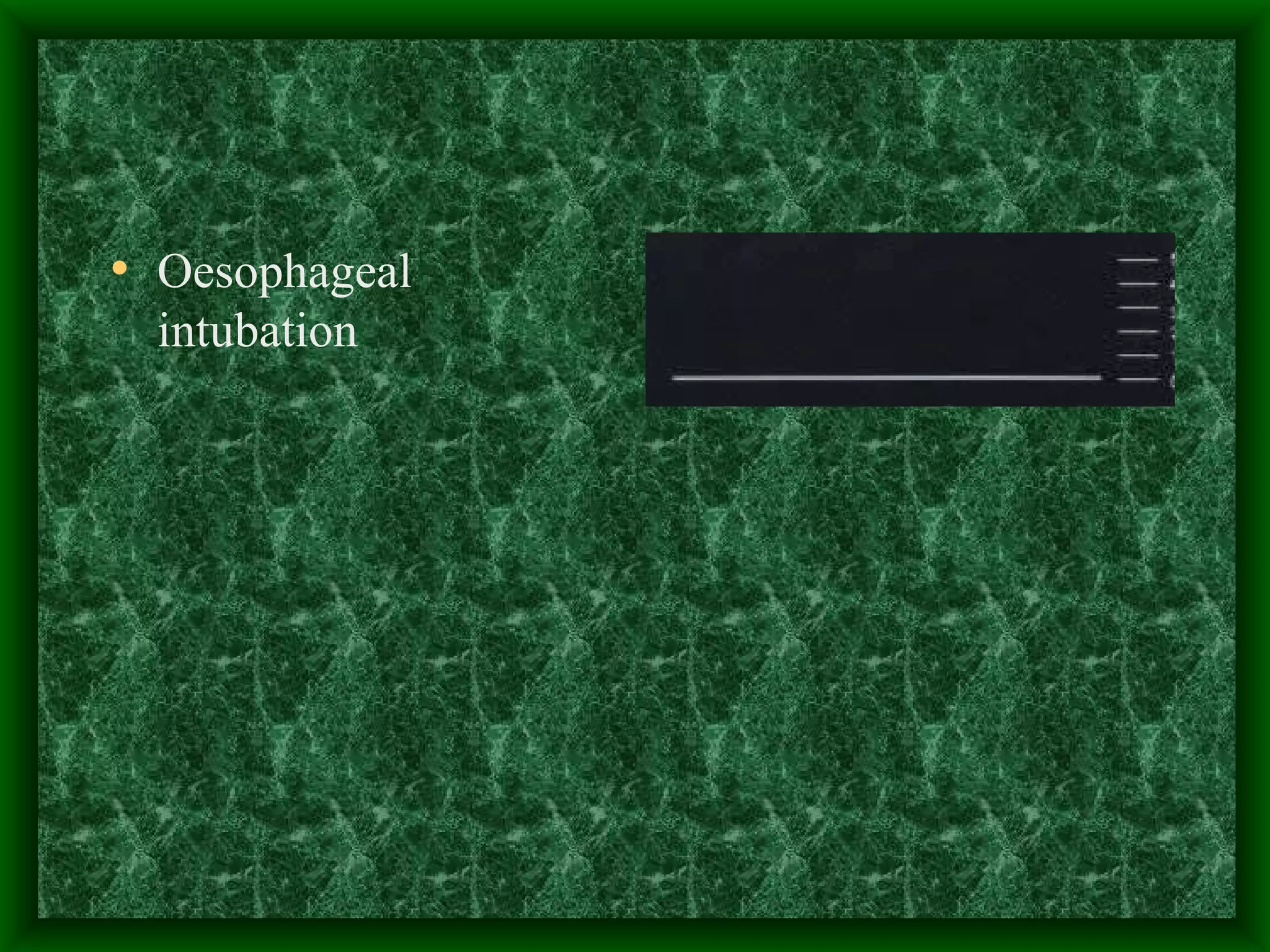 Oesophageal intubation