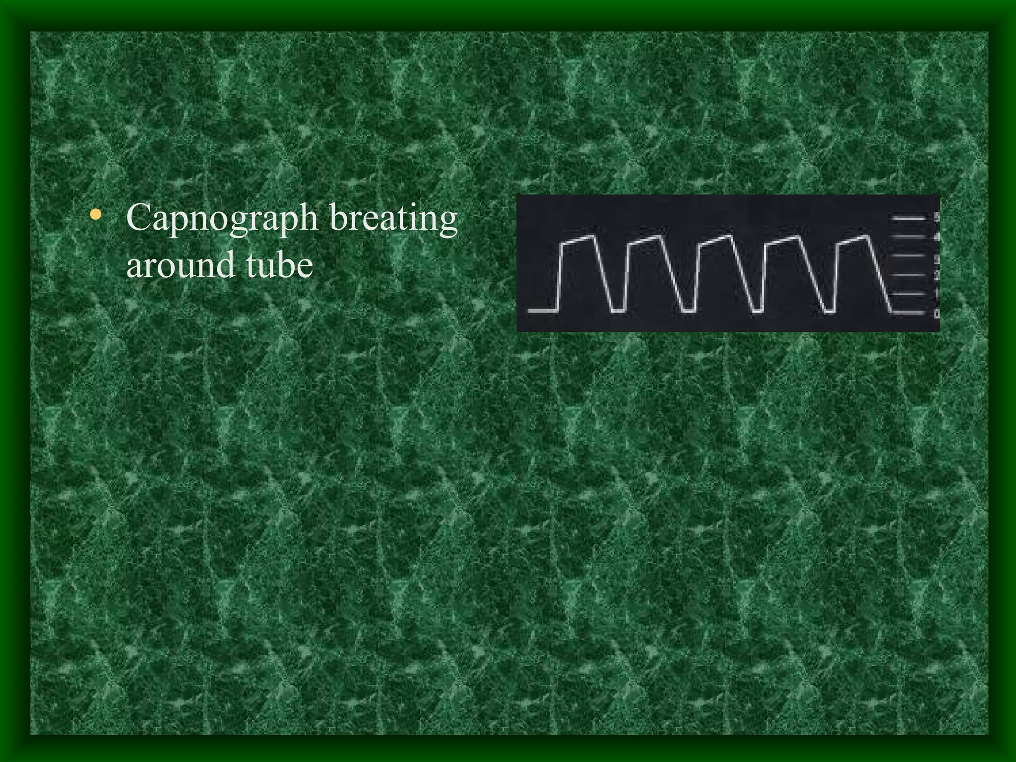 Capnograph breating around tube