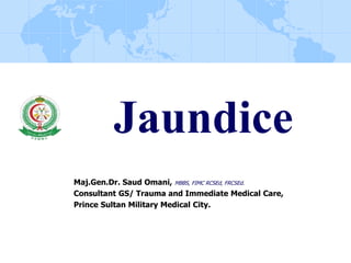 Jaundice
Maj.Gen.Dr. Saud Omani, MBBS, FIMC RCSEd, FRCSEd.
Consultant GS/ Trauma and Immediate Medical Care,
Prince Sultan Military Medical City.
 
