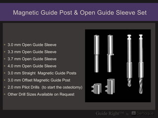 Magnetic Guide Post & Open Guide Sleeve Set




 3.0 mm Open Guide Sleeve
 3.3 mm Open Guide Sleeve
 3.7 mm Open Guide ...