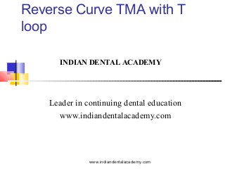 Reverse Curve TMA with T
loop
INDIAN DENTAL ACADEMY

Leader in continuing dental education
www.indiandentalacademy.com

www.indiandentalacademy.com

 