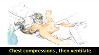 15Chest compressions , then ventilate
 