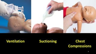 Chest
Compressions
9
SuctioningVentilation
 