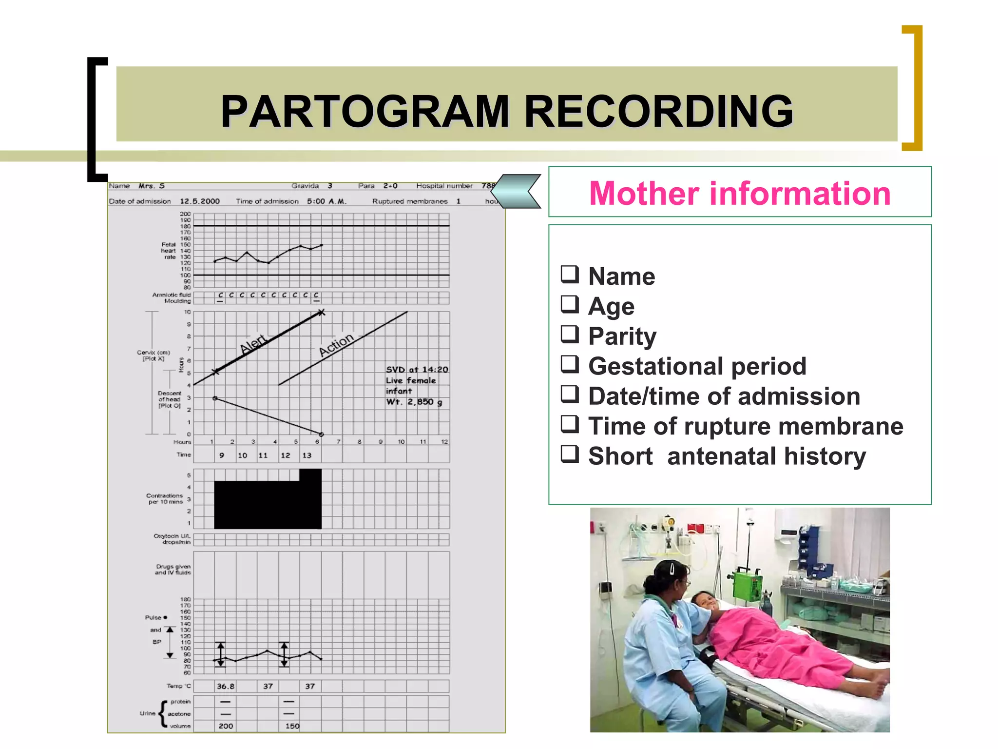 PARTOGRAM RECORDING Mother information Name Age Parity Gestational period Date/time of admission Time of rupture membrane Short   antenatal history   