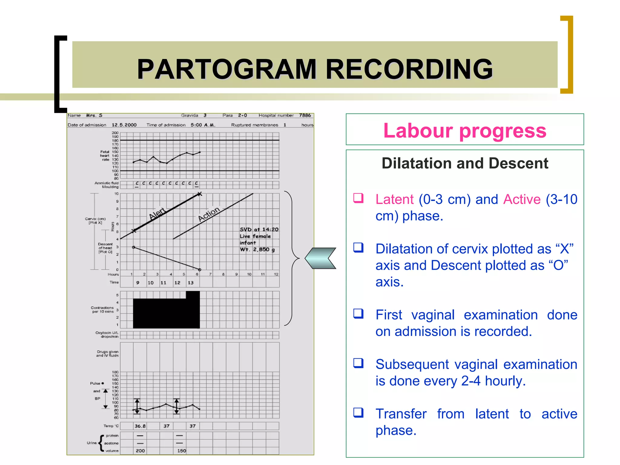 PARTOGRAM RECORDING Labour progress Dilatation and Descent Latent  (0-3 cm) and  Active  (3-10 cm) phase. Dilatation of cervix plotted as “X” axis and Descent plotted as “O” axis. First vaginal examination done on admission is recorded. Subsequent vaginal examination is done every 2-4 hourly. Transfer from latent to active phase. 