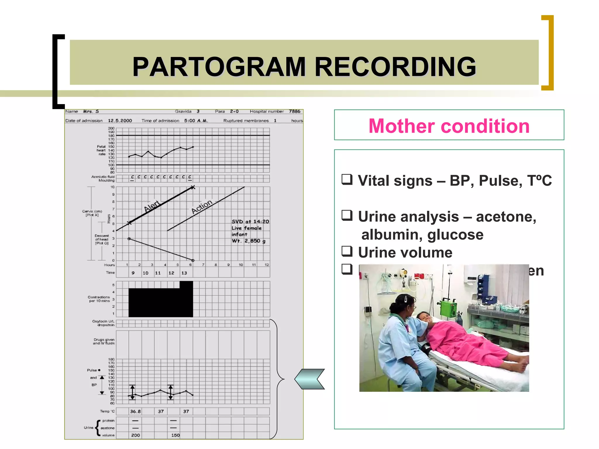 PARTOGRAM RECORDING Mother condition Vital signs – BP, Pulse, T ºC   Urine analysis – acetone,  albumin, glucose  Urine volume Medications or drug given 
