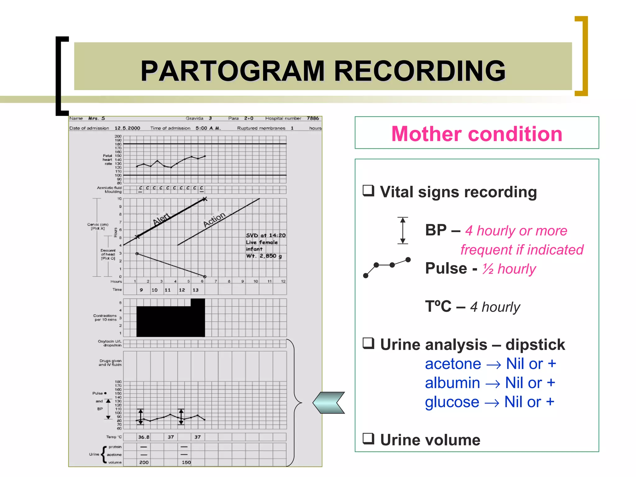 PARTOGRAM RECORDING Mother condition Vital signs recording  BP –  4 hourly or more    frequent if indicated   Pulse   -   ½ hourly T ºC  –  4 hourly   Urine analysis – dipstick acetone    Nil or +  albumin    Nil or + glucose    Nil or + Urine volume  
