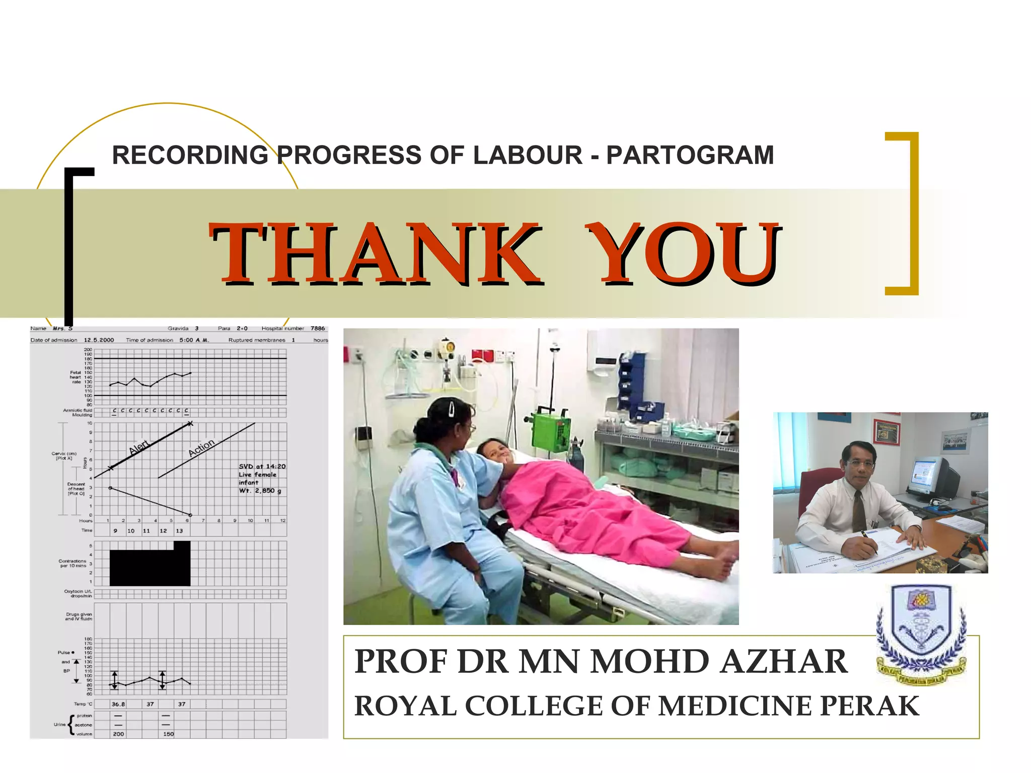 THANK  YOU PROF DR MN MOHD AZHAR ROYAL COLLEGE OF MEDICINE PERAK RECORDING PROGRESS OF LABOUR - PARTOGRAM 
