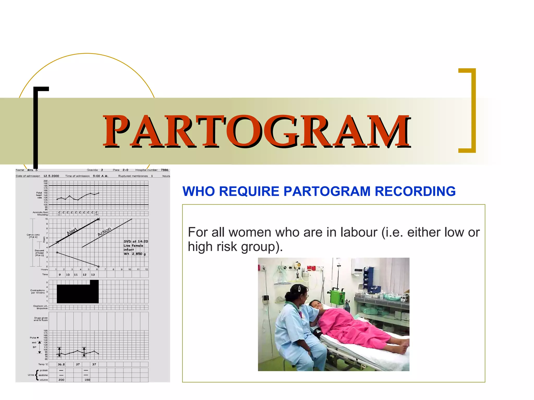 PARTOGRAM For all women who are in labour (i.e. either low or high risk group). WHO REQUIRE PARTOGRAM RECORDING 